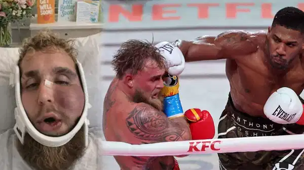 Yüzü tanınmaz hale geldi: Jake Paul saniyede 4 milyon TL kazandı!