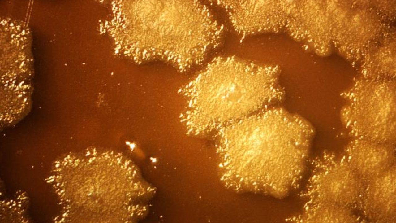 Kanser tedavisinde biyolojik devrim: Tümörü içeriden yok eden 'akıllı' bakteriler geliştirildi