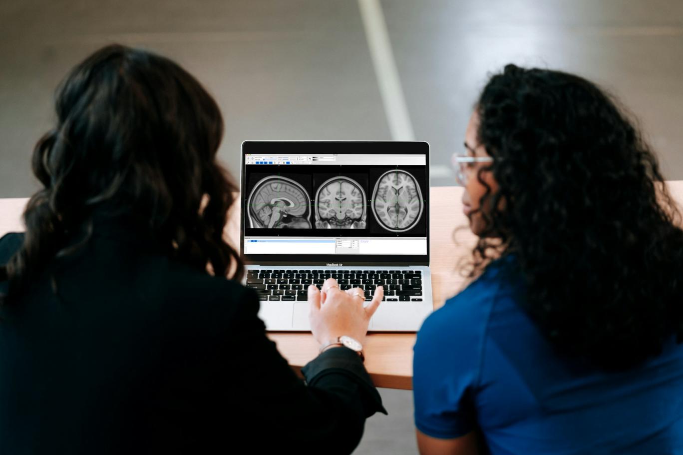 Alzheimer'ın hasarını giderebilen protein tespit edildi
