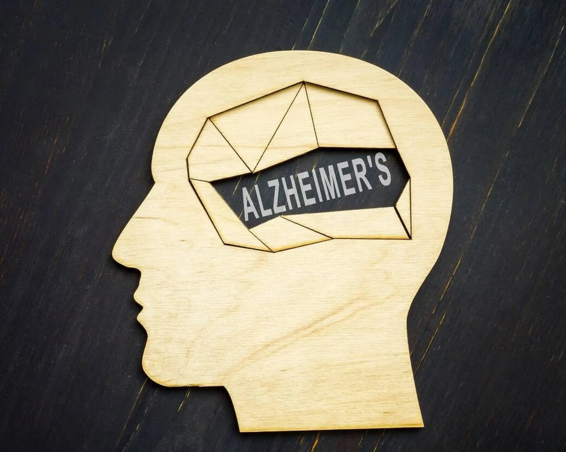 Alzheimer denemesi, hastalık belirtileri olmayan kişiler üzerinde yapılacak